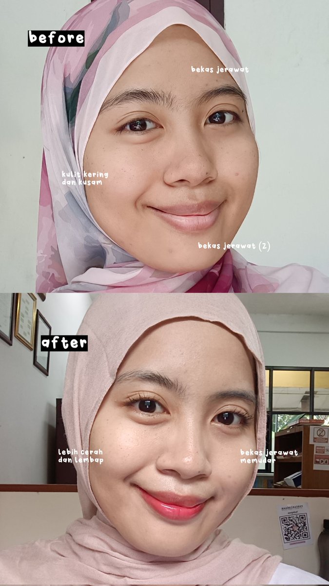 itsmefaraww's tweet photo. I FINALLY FOUND: top of the TOP “barrier cream” yang bisa bantu cerahin kulit juga (selain jaga skin barrier)🫶🏻

safe for sensitive &amp; acne prone + dermatologically tested💯 https://t.co/WJV0XQiVw7