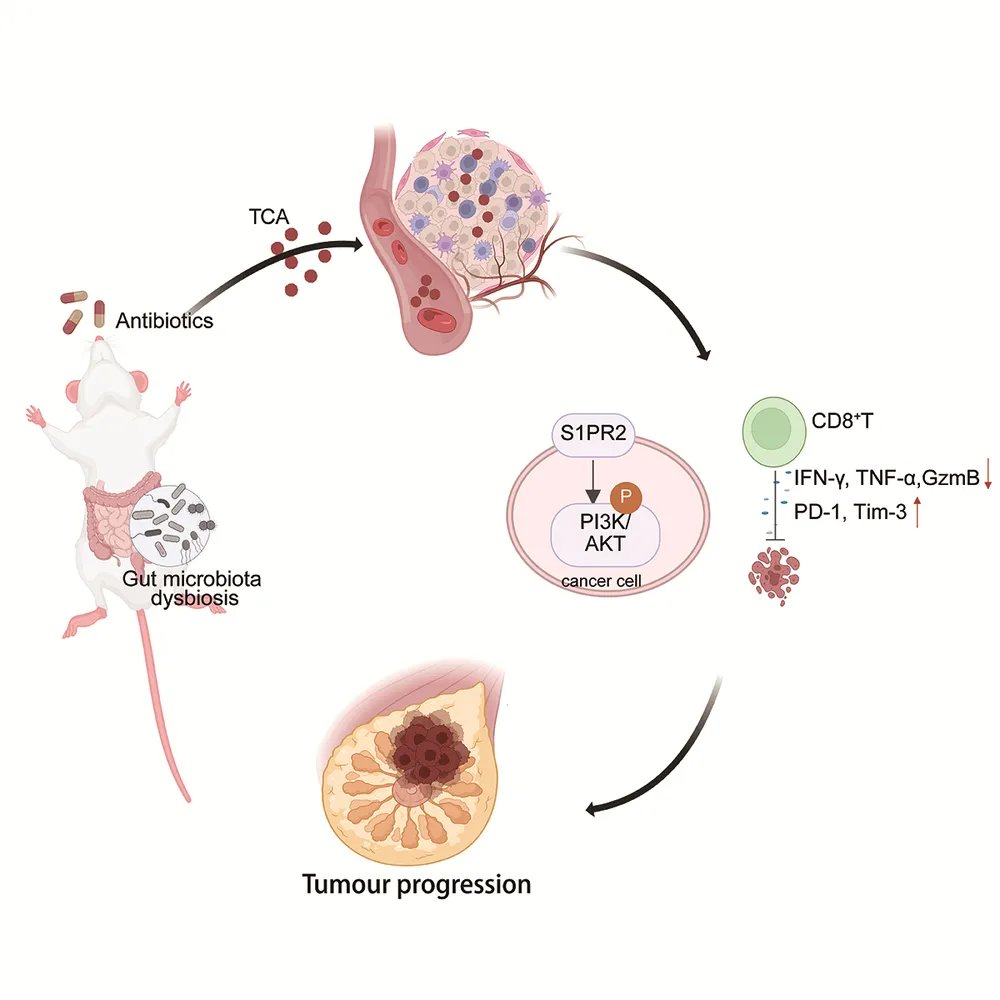 ABBSjournal's tweet photo. 🎊Oral antibiotics promote triple-negative breast cancer progression by inducing gut microbiota dysbiosis and taurocholic acid accumulation
https://t.co/MJIHtCzKOH

#antibiotic #gut microbiota #metabolite #triple-negative breast cancer #taurocholic acid https://t.co/1sZmNZxfTT
