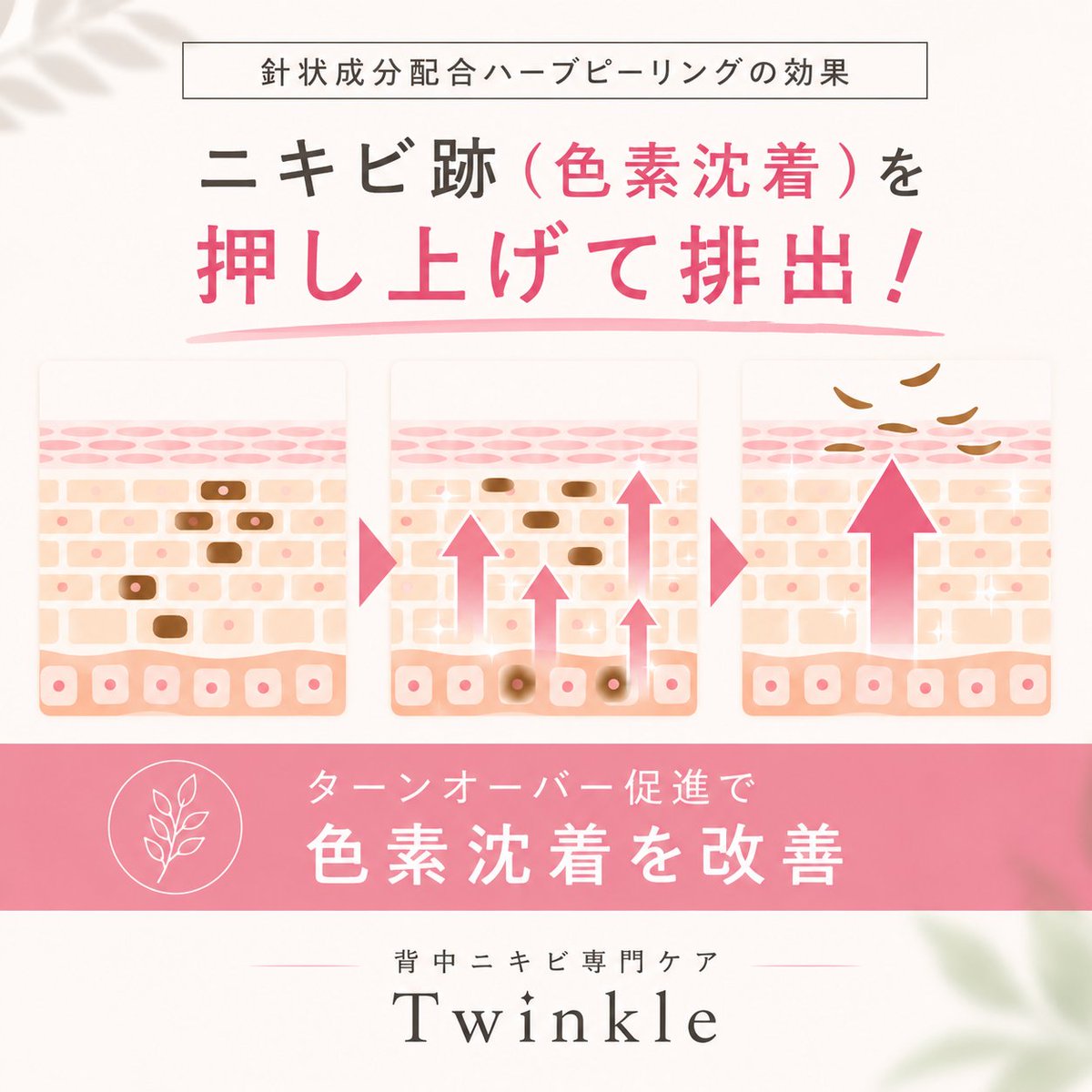 twinkle_este's tweet photo. 背中の上部、特に肩まわりはニキビができやすい部分。
しかも、この部分はニキビ跡（色素沈着）が残りやすい！
背中は顔より肌の生まれ変わりが遅いため、ニキビ跡がなかなか改善しません。
放置するほど色素沈着が定着し、改善にも時間がかかります。
針状成分配合のハーブピーリングで肌の生まれ変わりを促進。
ニキビ跡（色素沈着）をどんどん押し上げて、排出していきます。