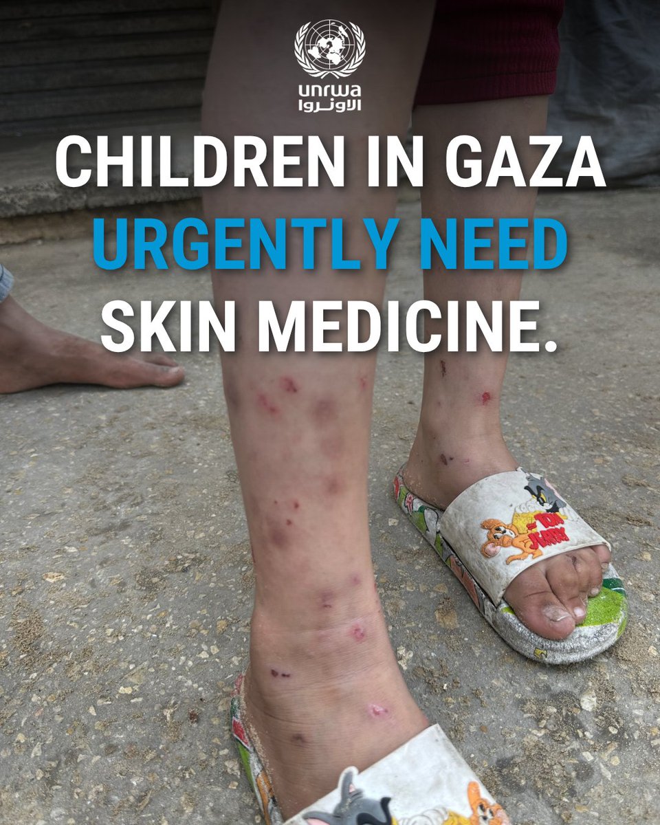 UNRWA's tweet photo. The  surge in infestations of rodents and parasites in #Gaza are affecting people’s health, including that of children.

UNRWA’s sanitation teams continue working to try to control the infestations and our health teams are treating people.

But with limited supplies, the response is not as effective as it could be. Supplies need to be allowed into Gaza at scale. 

#UNRWAworks