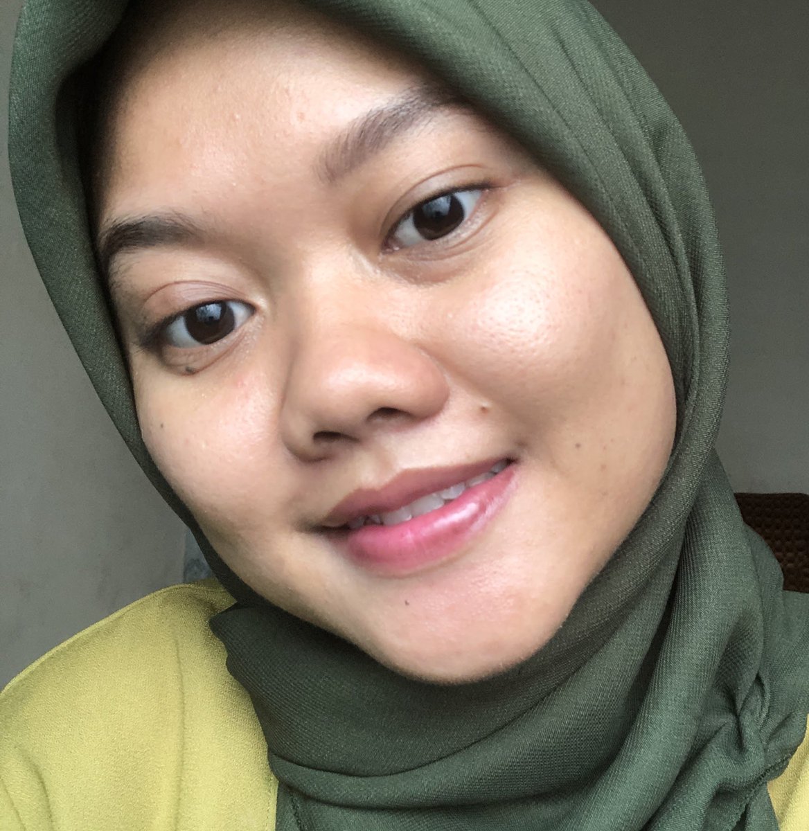manaaaasi's tweet photo. my skin progress : Nyobain serum brightening lokal yang isinya BAGUS buat kulit kusam dan PIH

Tim kulit kusam dan PIH merapatt☝🏻! https://t.co/NeNkfgVEVX