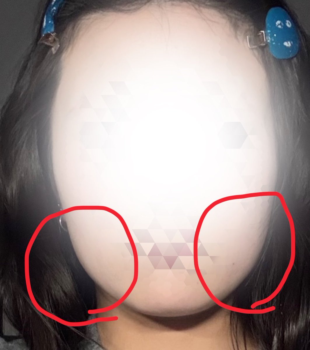 ykmrsko8o8's tweet photo. 赤丸のとこ引き上げたいんだけどどうすれば良いんですか？😭😭😭
糸とかはコスパ悪いって言われたし何が正解か分かんない😭😭😭😭😭 https://t.co/ZKnZVHF1D3
