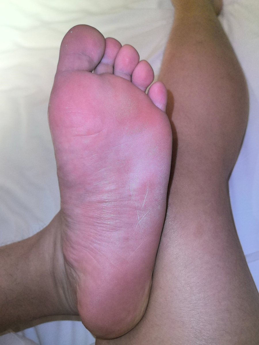 pbh20041220's tweet photo. 傻逼贱脚已执行完毕🤪
抽的时候一直在发抖🥹
贱脚抽肿后好想被当飞机杯用🥵
视频太长了，转推抽😁
#打脚心 https://t.co/0MjE4hs3Bg