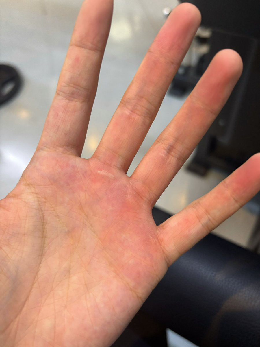 Neossolo's tweet photo. 这下要把自己丝袜挂勾丝了 https://t.co/OBIBfDXwHf