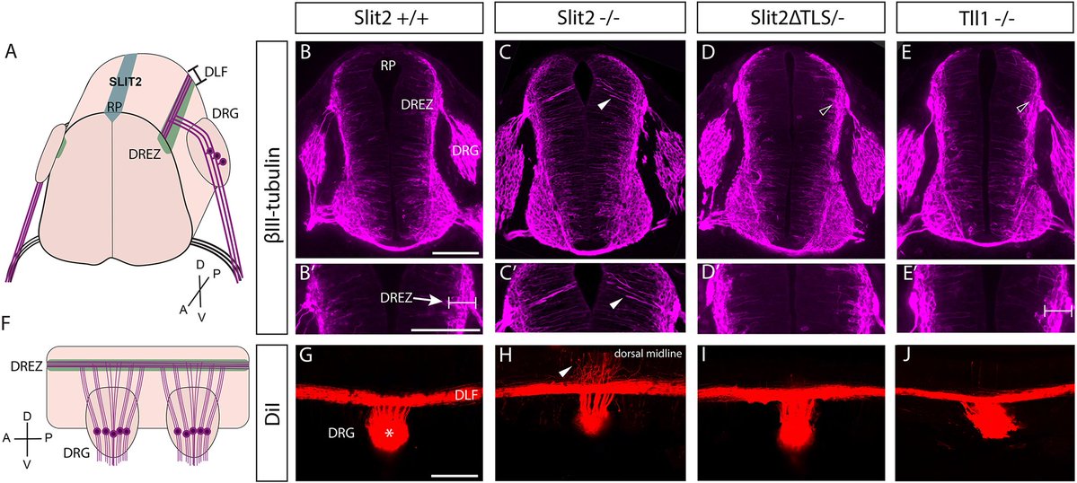 Dev_journal's tweet photo. SLIT2 repellent is cleaved by TLL1 protease and promotes sensory axon fasciculation

Read this Research Article from our special issue #DevSIextracellular by @laurenliz_j, @Thomashkidd, Grant Mastick &amp; co from @unevadareno. 

https://t.co/dDTJnZXPYT https://t.co/KH3qoeS7Ks