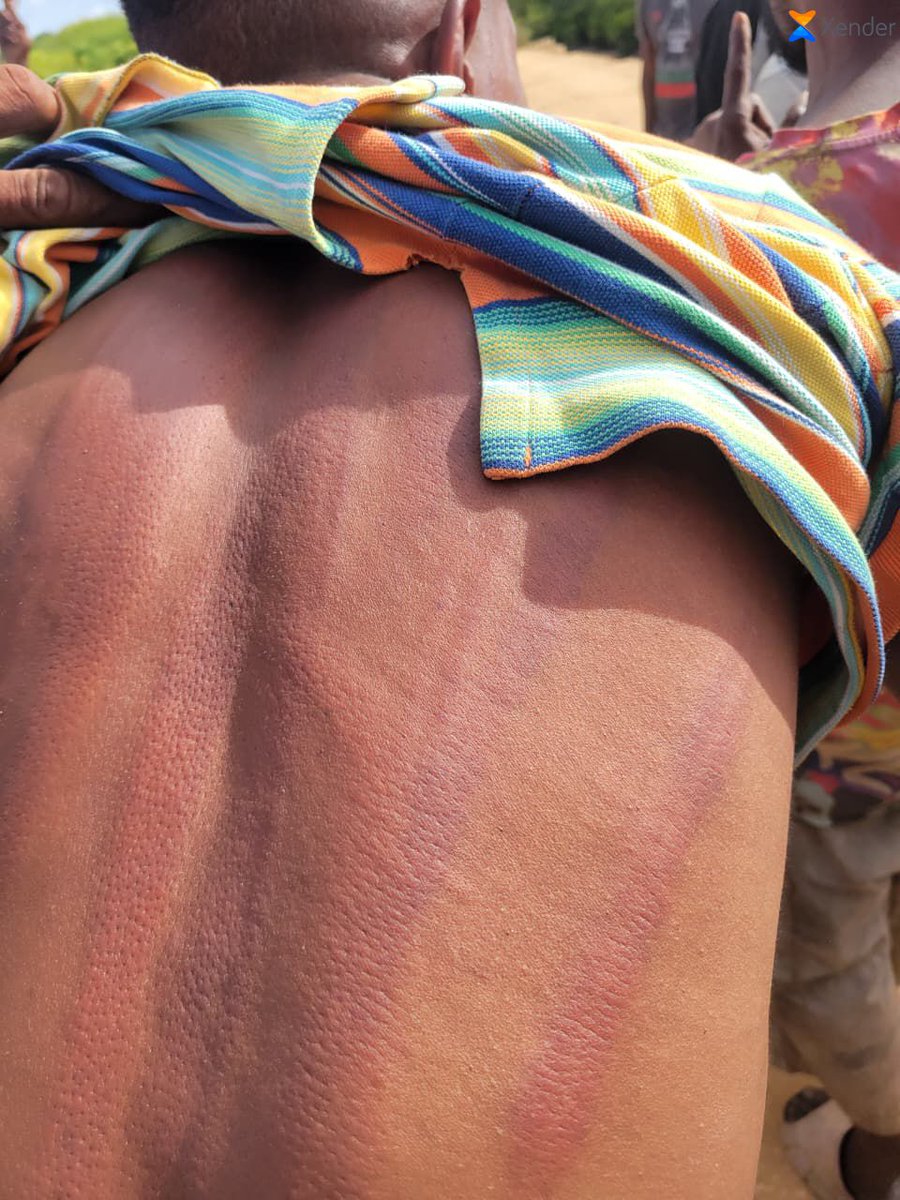 MUHURIkenya's tweet photo. As we are writing this, at least 16 people from Siyu Island in Lamu East have been brutalized by people they can't identify. We believe the president or his office knows we these people are.

There's so many negative things happening in Kenya Kenya right, and those sworn to 
1/ https://t.co/JDlRoHnv6j