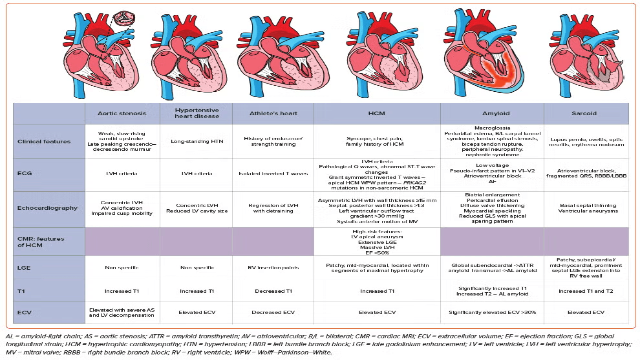 radcliffeCARDIO's tweet photo. 📚 New #USCJournal Article: "Diagnostic Approach to Left Ventricular Hypertrophy"

📚 Just Published!

🔓Access it here 👉 https://t.co/O8yVixHeMX

@sukritibanthiya @CardioNerds #CVImaging #MedEd #CardioEd #Electrophysiology #Arrhythmia #HeartFailure #CardioTwitter https://t.co/9lYWvqPdQD