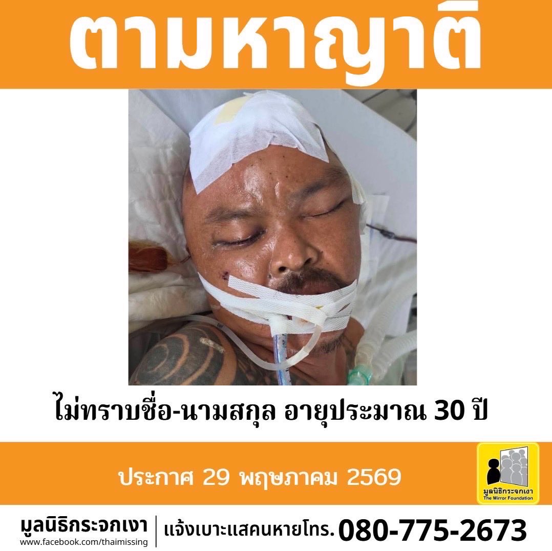 Mirror_org's tweet photo. ***ประกาศตามหาญาติ***
.
ผู้ป่วยเพศชาย ไม่ทราบชื่อ ไม่ทราบนามสกุล อายุประมาณ 30 ปี รูปร่างสมส่วน สูงประมาณ 160 ซม. น้ำหนักประมาณ 60 กก. ผิวดำแดง ผมสั้น ผมสีดำ มีตำหนิรอยสักบริเวณลำตัว และรอยสักบริเวณแขนทั้งสองข้าง
.
เมื่อวันที่ 14 พฤษภาคม 2569 ศูนย์เอราวัณรับผู้ป่วยจากบริเวณเคหะชุมชนรามอินทรา 1 แขวงท่าแร้ง เขตบางเขน กรุงเทพมหานคร พบถูกทำร้าย หมดสติ ขยับตัวไม่ได้ ไม่มีเอกสารแสดงตัว ปัจจุบันไม่สามารถให้ข้อมูลตนเองได้ โรงพยาบาลภูมิพลอดุลยเดชมีกระบวนการติดตาม คัดข้อมูลทางทะเบียนราษฎรแล้ว แต่ไม่พบข้อมูล 
.
ทั้งนี้หากท่านใดเป็นญาติ หรือรู้จักกับชายในภาพ กรุณาติดต่อ ศูนย์ข้อมูลคนหาย มูลนิธิกระจกเงา โทร 080 775 2673
.
ประกาศนี้ได้รับการอนุญาตจากโรงพยาบาลภูมิพลอดุลยเดช  
ประกาศเมื่อ 29 พฤษภาคม 2569