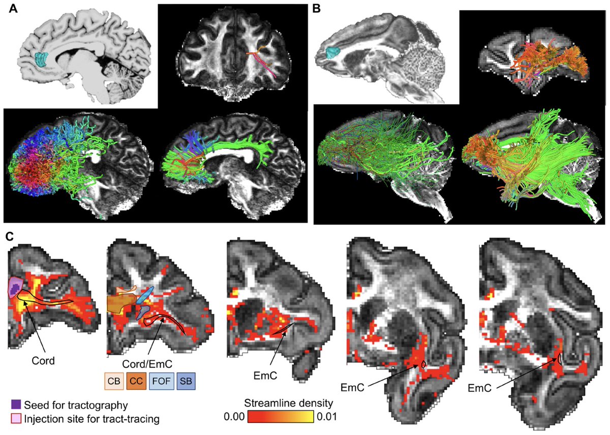 ImagingNeurosci's tweet photo. New paper in Imaging Neuroscience by Wei Tang, Eleftherios Garyfallidis, et al:

Mapping the structural connections between the anterior cingulate cortex and the insula/ventrolateral prefrontal cortex

https://t.co/NZXH3V1A1U https://t.co/lvBgjCDhsR