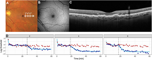 ARVOiovs's tweet photo. Maximilian Pfau et al. from the University of Bonn investigate parafoveal dark adaptation in early and intermediate age-related macular degeneration. 
https://t.co/z56XDfWq00 https://t.co/GcG57D0Vf7