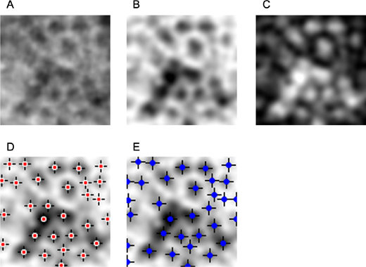 ARVOtvst's tweet photo. Masakazu Hiraoka et al. from Kobe City Eye Hospital validate a rule-based automated method for RPE cell detection using adaptive optics transscleral flood illumination. 
https://t.co/KLMvyf7ZfU https://t.co/HDePnUgt0A