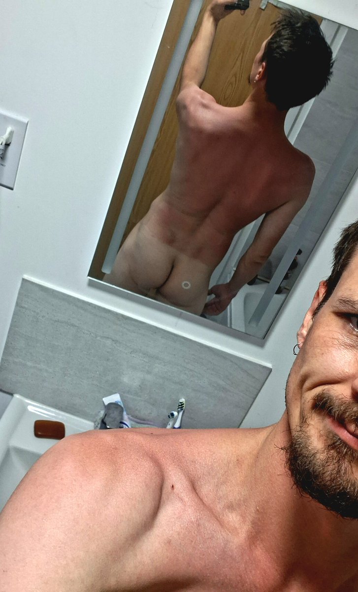 JakeDaniel32806's tweet photo. Can safely say I have caught the sun, just need help with rubbing cream in. https://t.co/oDfm6iHoE9