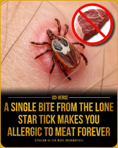 coinviewing's tweet photo. You heard of Alpha Gal Syndrome? $AGS 

Oh Boy you will see the Lone Star Tick this Weekend 

CarsFGUSMC69ufRMdpwYy6sjMmFrAzgcqjYscFiBy3am https://t.co/MsGmWLet9F