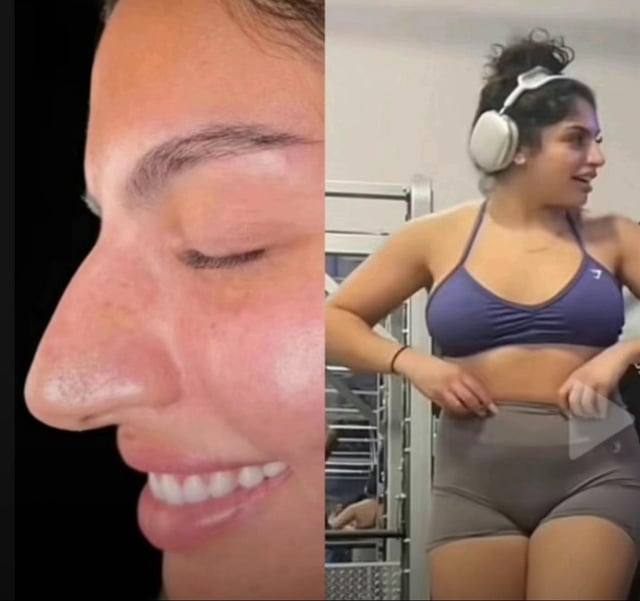 allmightysimp's tweet photo. @peoplesobsesn @love_v4n3ss4 @zarajimuq2k Nah what we're not going to do is pin two beautiful black women against each other just bc we're insecure over the fat troll who needed 20+ plastic surgeries to still look ugly https://t.co/vNkIQxVmoP