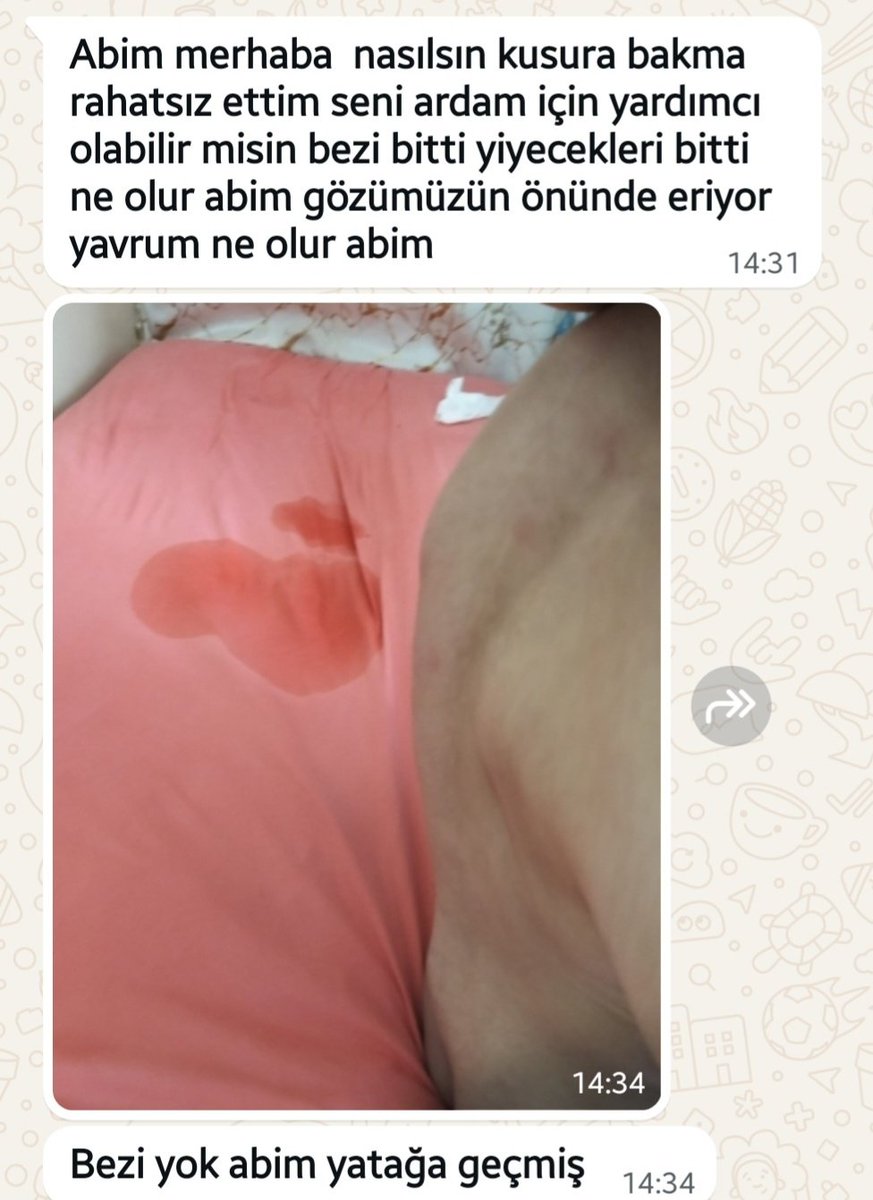 Yardimder2019's tweet photo. İyi Bayramlar.
Arda %100 engelli yatağa bağlı bir evladımız 

Bezi ve mamaları bitti.
Acil 5.000 tl lik bir ihtiyacı var. https://t.co/ABO2FfYJOW