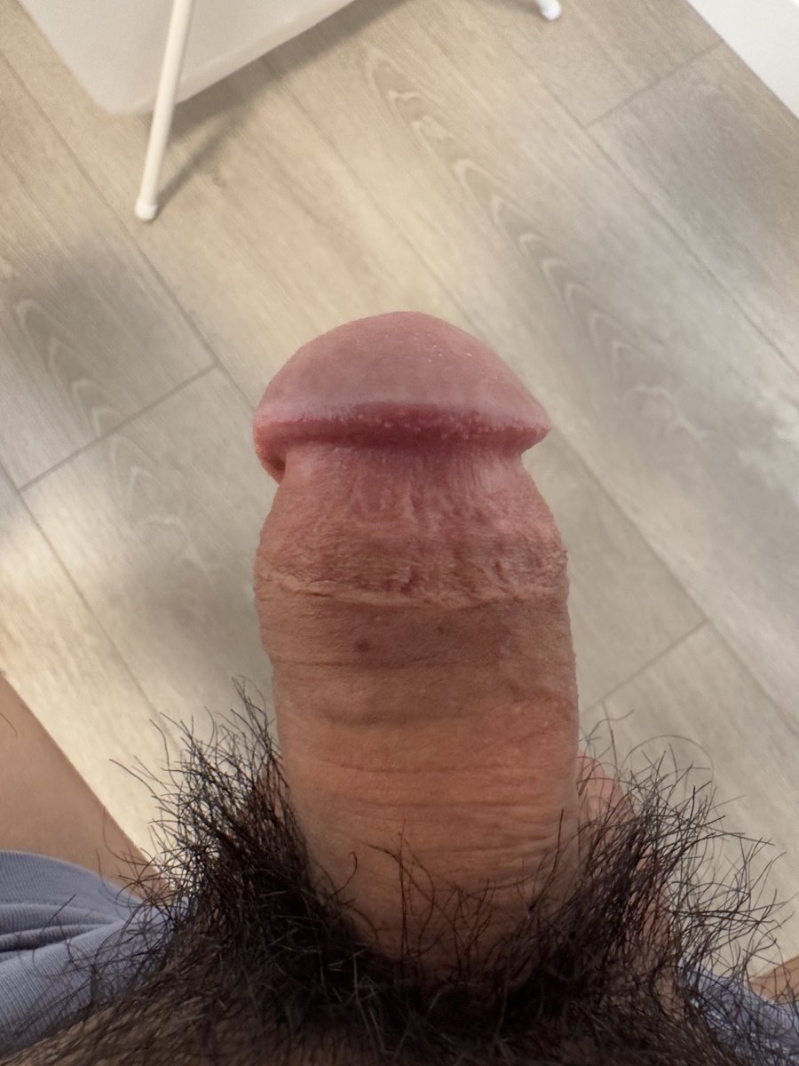 subincision_boy's tweet photo. 开得越多，阴茎越向下弯  #subincision #开马眼 #开尿道 https://t.co/cbQrsKKV2S