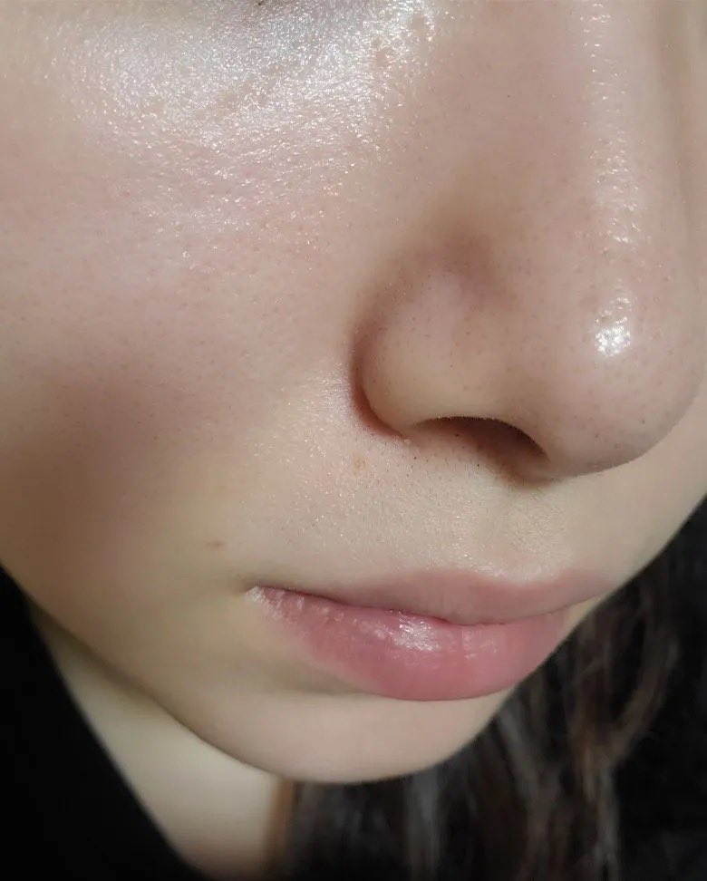 venggk's tweet photo. GILA SIH kok bisa gw baru kepikiran nyoba ini 😭

area hidung gw yg biasanya komedo &amp; pori porinya selalu bikin kesel tiap ngaca, sekarang udh jauh lebih rapi dari dulu￼ https://t.co/snMdHW6vKX