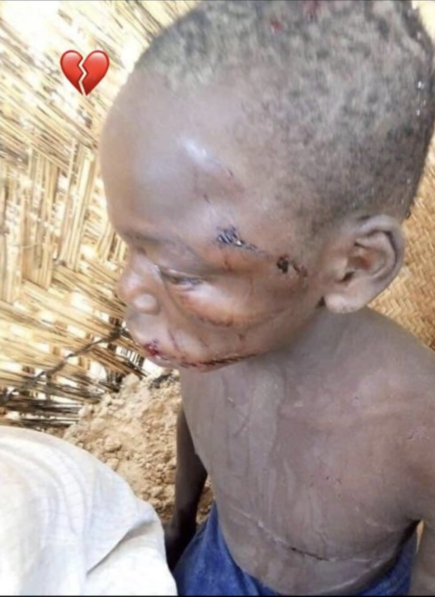 orchi_man's tweet photo. @ANTHONYBLOGAN Pray for Nigeria. Nigerian kids are still held by terrorists while leaders focus on 2027 politics. These are innocent children, not campaign topics. Rescue them now. Listen to this buffoon is describing about the insecurity like a drunk man #HELPNIGERIAKIDS https://t.co/mpNyJSaQYc