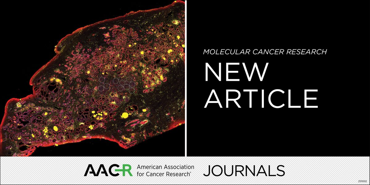 MCR_AACR's tweet photo. Now online: Mapping the Subtype-Specific PARP1 ADP-ribosylated Proteome in Breast Cancer Cells https://t.co/JJSJSMnrPj https://t.co/GWv6G988NW