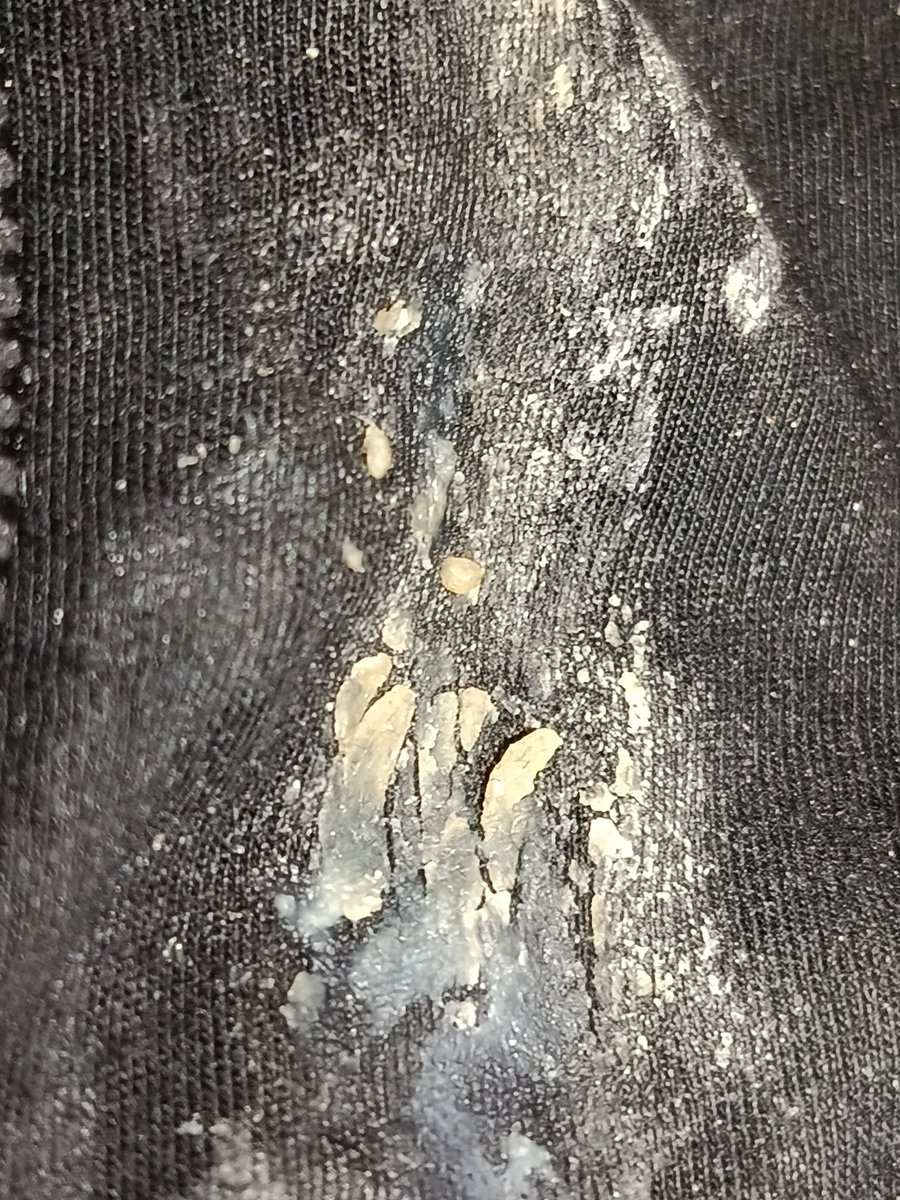 ArtistScat's tweet photo. She gave me another amazing dirty  panties 😱 omg. I already ate the big chunks 😳
#dirtypanties https://t.co/fcE1lDT7b9