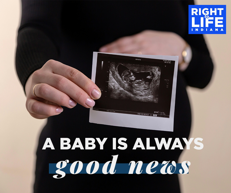 irtl's tweet photo. A baby is always a GIFT! 💙 https://t.co/xJSgfCv2Iv
