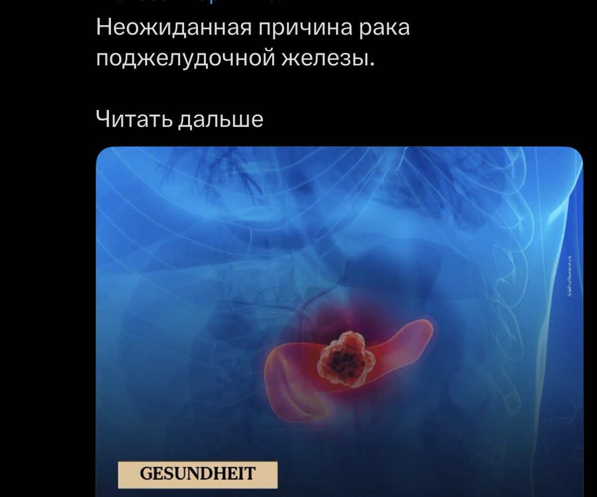 gitpush__force's tweet photo. второй день несильно, но ощутимо побаливает живот слева

твиттер: https://t.co/dFG5N5lixA