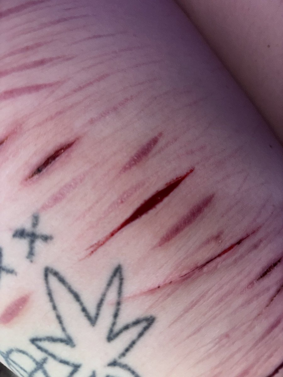 necrokitty420's tweet photo. 1st time cutting irl w sum1 (w my irl bsf) last night + ft seshy w oomfie + sum lines:3 @lesbianintow @Nadiaslaaays
fake blood fake cuts #slitwt #cutspo #beanspo #styrospo #styrotwt #shedtwt #shtwt #fakebody #seshy #drugtwt #bpdtwt #multiswipe #sledtwt
#shedbuildertwt https://t.co/6WQpeETEyd