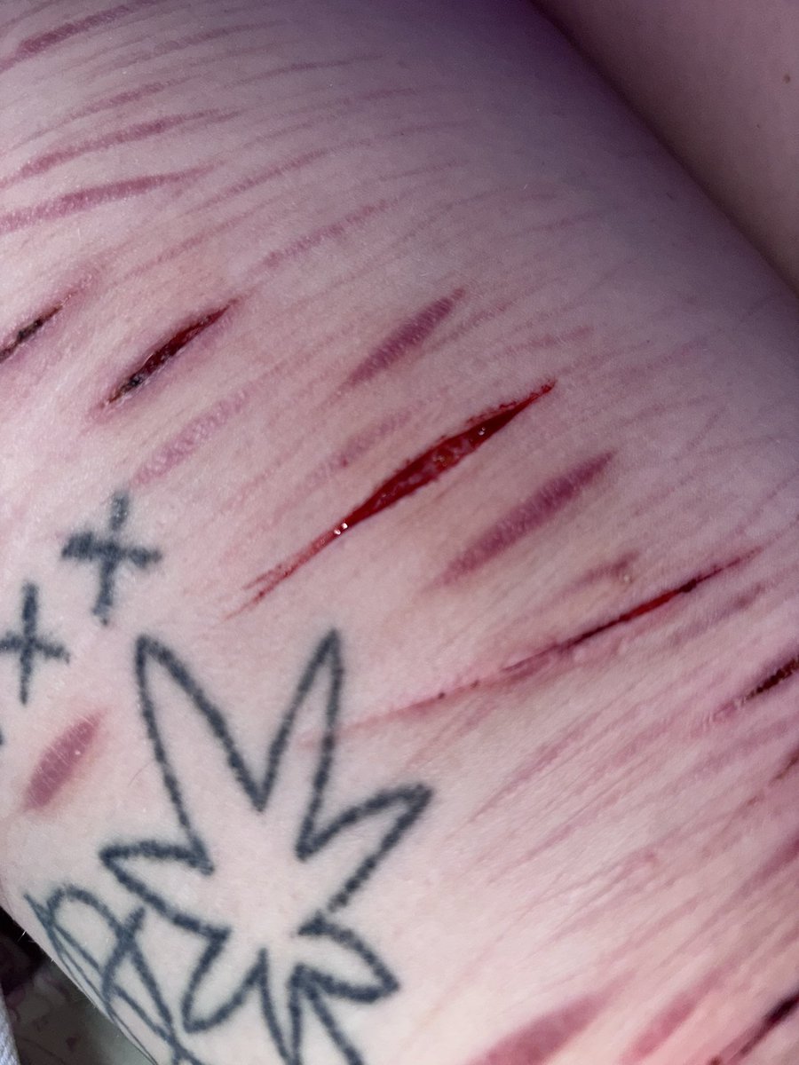 necrokitty420's tweet photo. 1st time cutting irl w sum1 (w my irl bsf) last night + ft seshy w oomfie + sum lines:3 @lesbianintow @Nadiaslaaays
fake blood fake cuts #slitwt #cutspo #beanspo #styrospo #styrotwt #shedtwt #shtwt #fakebody #seshy #drugtwt #bpdtwt #multiswipe #sledtwt
#shedbuildertwt https://t.co/6WQpeETEyd