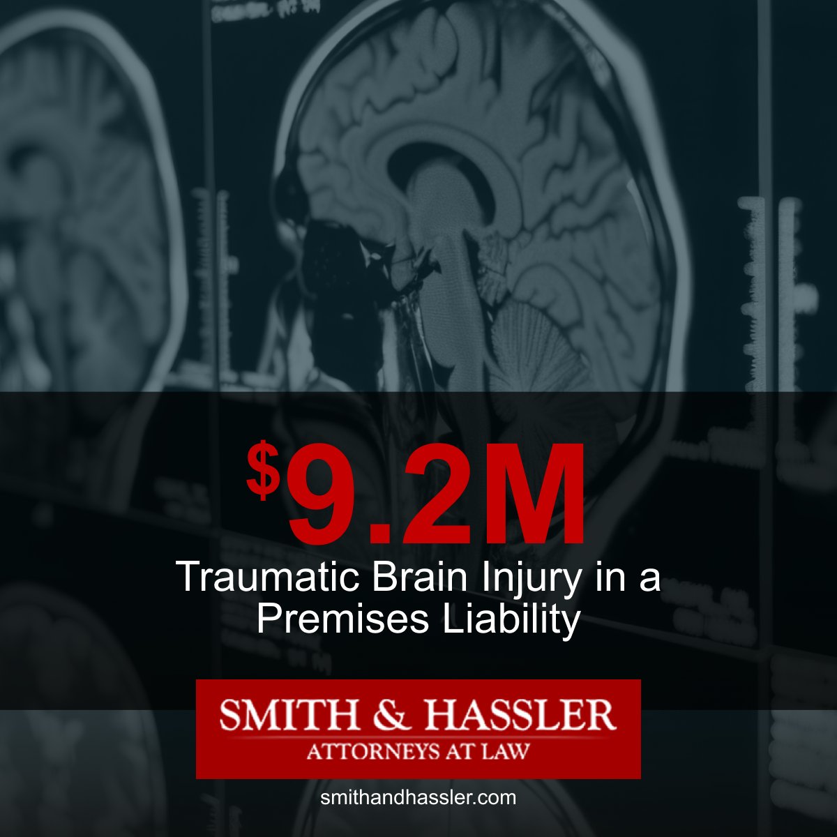 smithandhassler's tweet photo. We secured $9.2 million for our client, who suffered a traumatic brain injury due to unsafe property conditions. If you’ve been hurt due to negligence, our attorneys are here to fight for the justice you deserve.

Explore more of our case results here:
https://t.co/p1lwpNbX0S https://t.co/GhFMbyjWqb