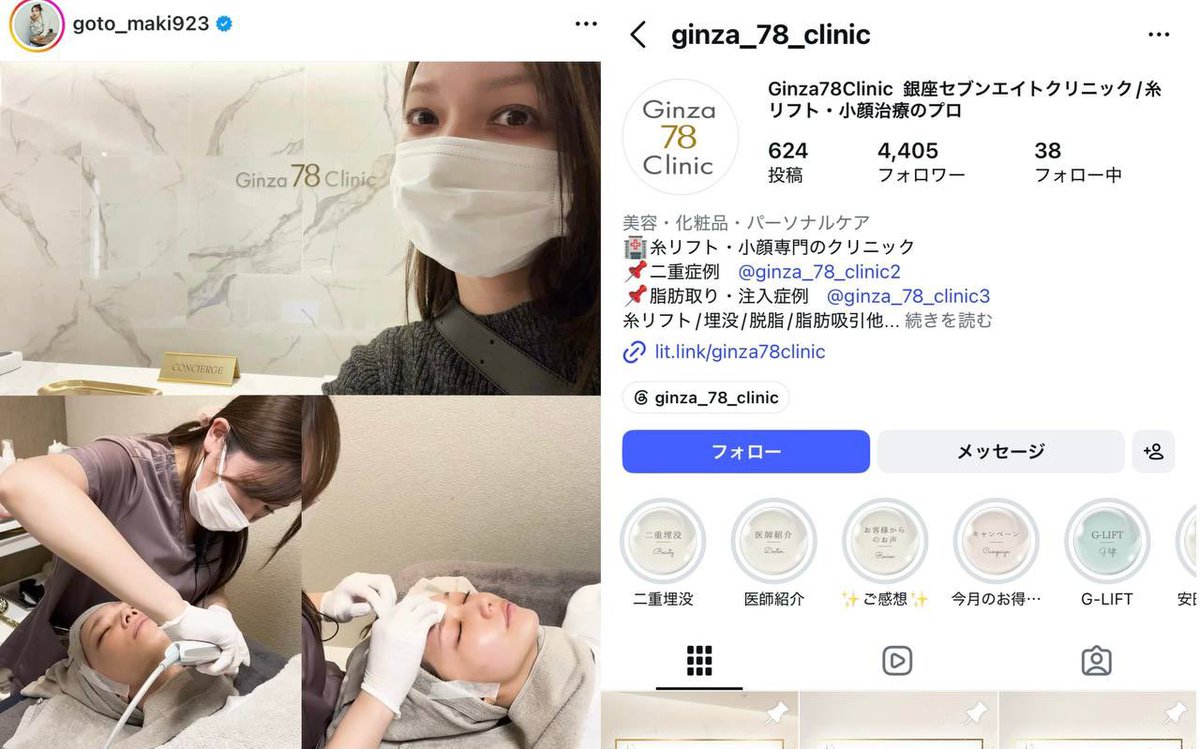 harapeko_cn's tweet photo. 芸能人肌治療クリニックまとめ🏥✨

田中みな実
📍青山ヒフ科クリニック
東京都港区北青山 表参道駅

指原莉乃
📍R.O. clinic
東京都渋谷区神宮前 表参道駅

後藤真希
📍Ginza78Clinic
東京都中央区銀座 銀座駅

辻希美
📍ラグラン銀座医院
東京都中央区銀座 銀座一丁目駅 https://t.co/8KY6aeenQh