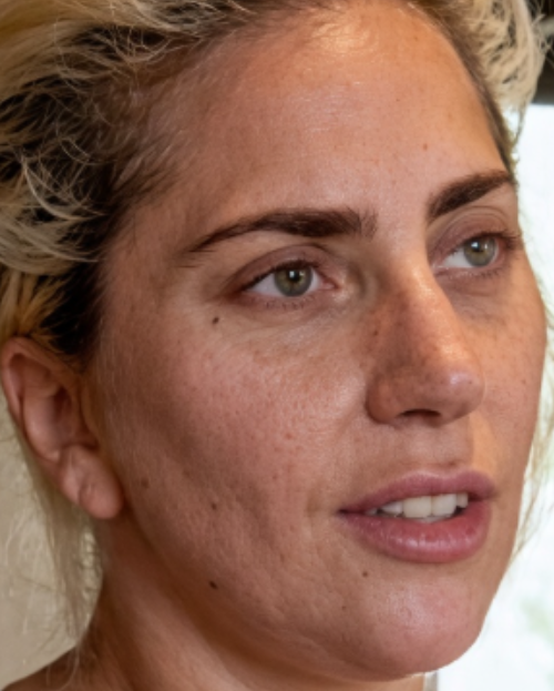 JebraFaushay's tweet photo. This is what real, untouched, unedited skin looks like. 

Lady Gaga and Margot Robbie without airbrushes, filters, and ring lights. https://t.co/opzgrN1cIN