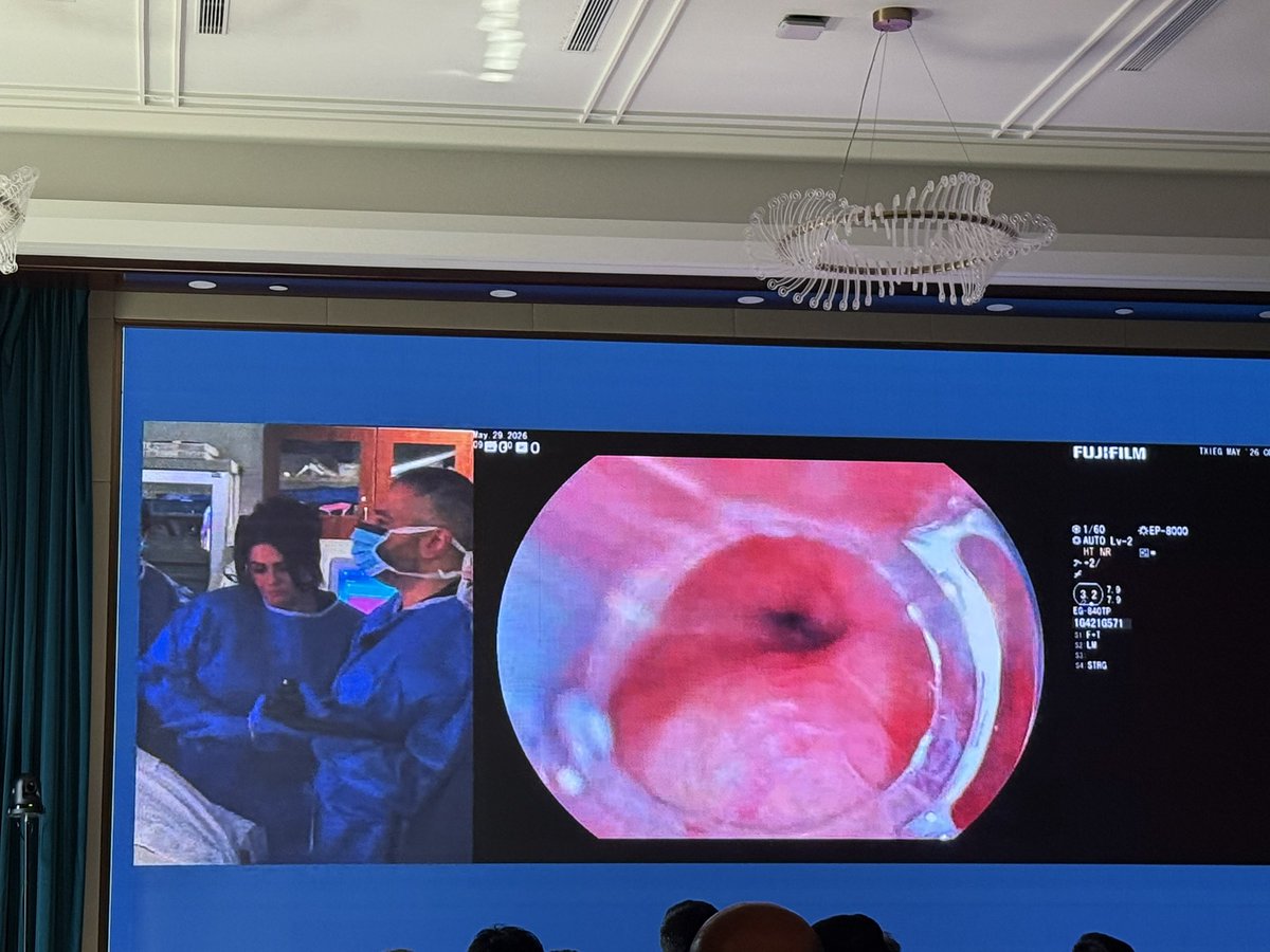 bcm_gihep's tweet photo. 👏 Live case of E-POEM for achalasia with our own Dr. @EndoscopyOthman and our motility expert Dr. @ReenaChokshiMD https://t.co/Jlhhu6nyxi