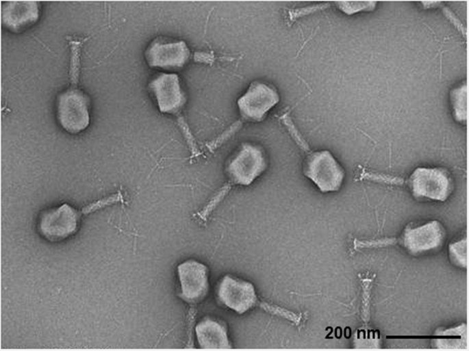 JakeArrived's tweet photo. I don't know why but looking at the bacteriophages here is making me laugh omfg. https://t.co/Go2zWAhwmr