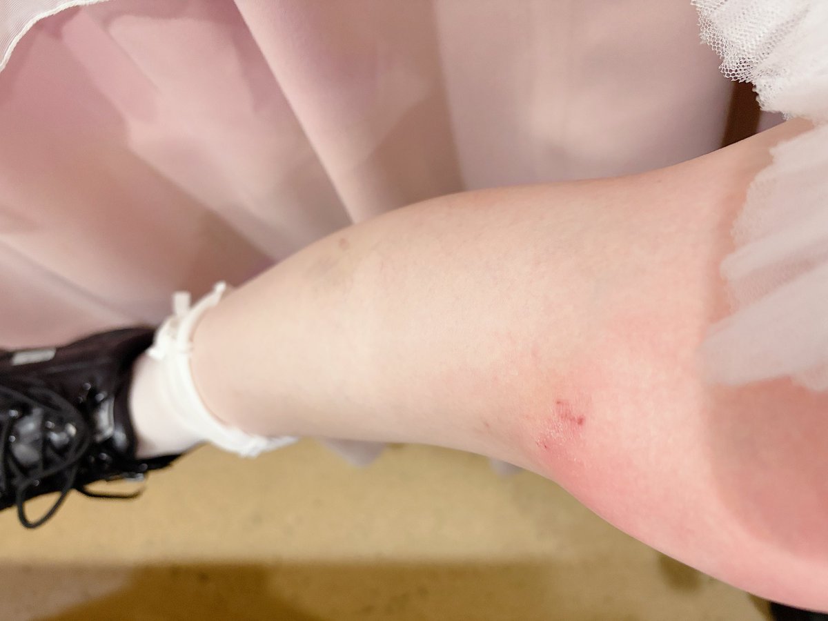 narumaid_'s tweet photo. まじあたしかわいそう https://t.co/lXQOIOcyTZ