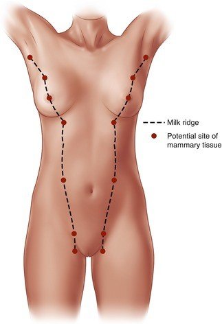 Willrandship's tweet photo. @Seo_JangHara3 humans are one tiny hormonal tweak (increased mammary TBX3 activity) from having as many as 14 breasts as it is https://t.co/LhuHhJRiju