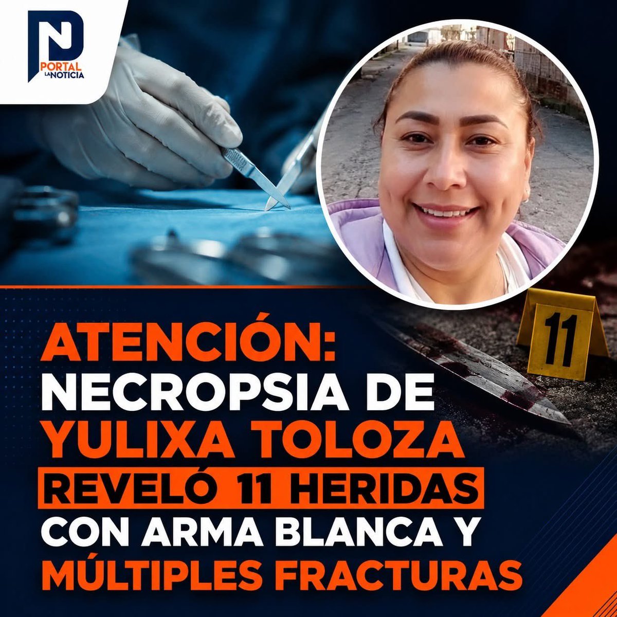 Planoticia's tweet photo. El informe pericial de necropsia elaborado por Medicina Legal sobre la muerte de Yulixa Toloza reveló la gravedad de las lesiones que presentaba su cuerpo tras someterse a un procedimiento estético que terminó en tragedia.
https://t.co/En51G4flsc https://t.co/jsmwUWjYv9