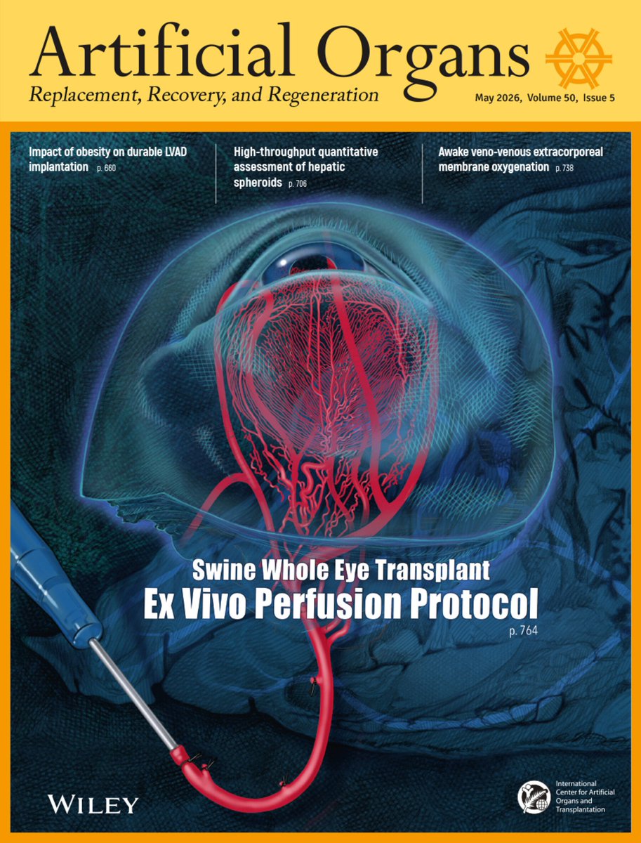 ArtifOrgans's tweet photo. #OnTheCover of our May issue: Swine #WholeEyeTransplant #ExVivoPerfusion Protocol
👉https://t.co/f9iYoDodDB
#ArtificialOrgans https://t.co/iiw0r3Vhzk