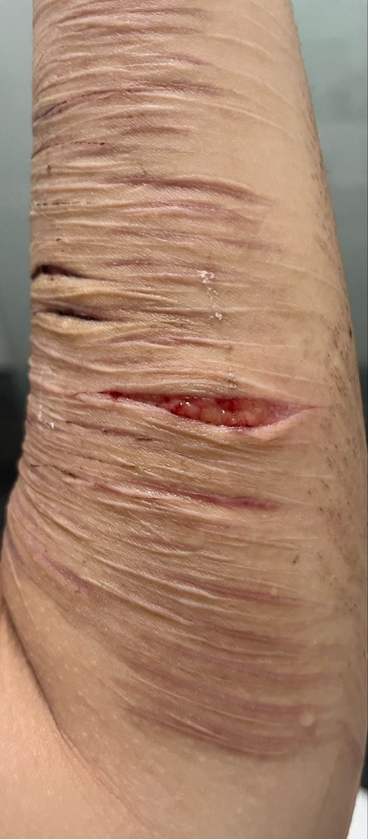 Leonloverwwe's tweet photo. Yk what I cleaned it in the end and here’s update. Also I tried to touch the fat tissue and it’s so soft like no resistance it’s like touching cloud https://t.co/Vgm5Pm71d9