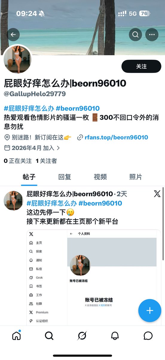 屁眼好痒怎么办 tweet media