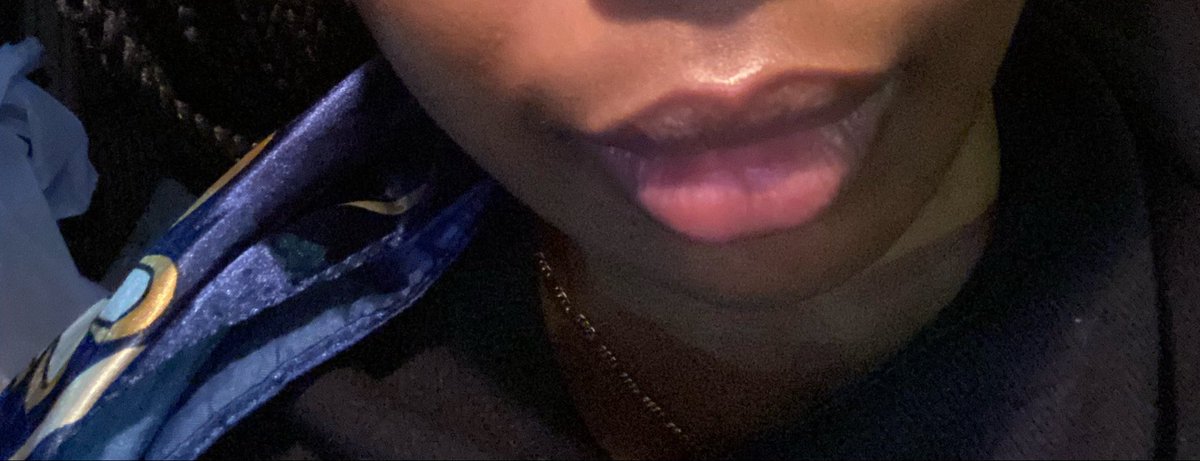 Kamyammaam5's tweet photo. 5 almost 6 months and they’re back to being so pink and pretty. I be wanting to smoke but then I think about the progress I’ve made 😩 https://t.co/KlY59AxpJH