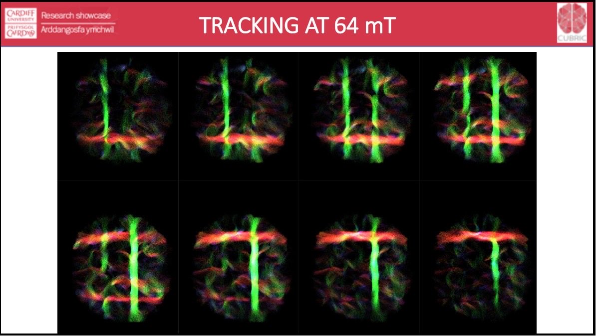 Preoperative's tweet photo. Thank you to Prof. Derek  Jones, and William Royer from Cardiff University Brain Research Imaging Centre (CUBRIC) for their ISMRM Diffusion Study Group Challenge that included PreOperative Performance's anisotropic diffusion phantom technology (POP-0005).

1/7 https://t.co/QgfpiDsIst