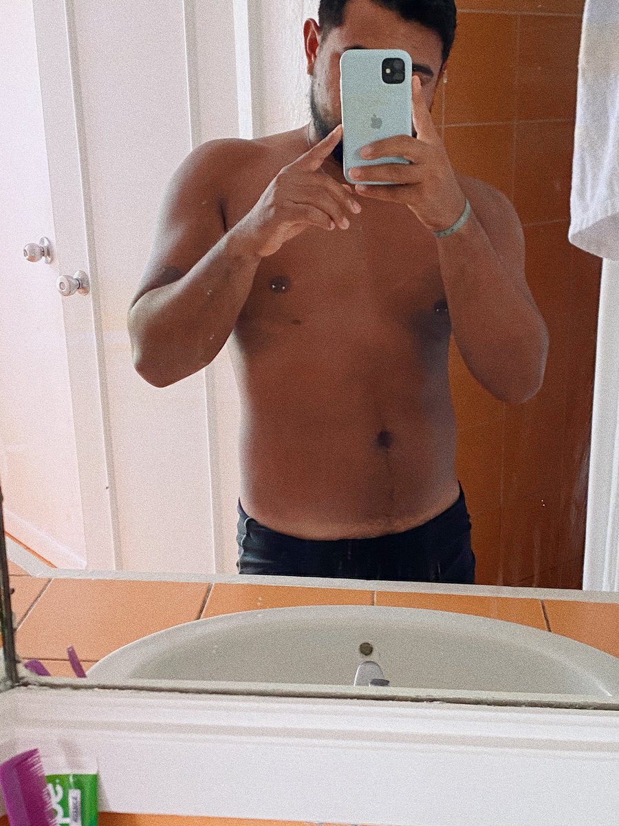 AlanBreeto's tweet photo. got a little burned 🐚 ☀️ https://t.co/ZxUkAbgFMM