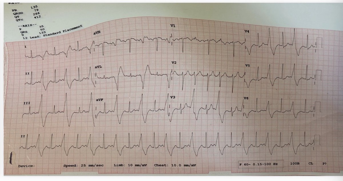 drameya's tweet photo. What is the SOO of this VT? @indian_rhythm @HRSonline #EP #VT https://t.co/oswup3G08Z