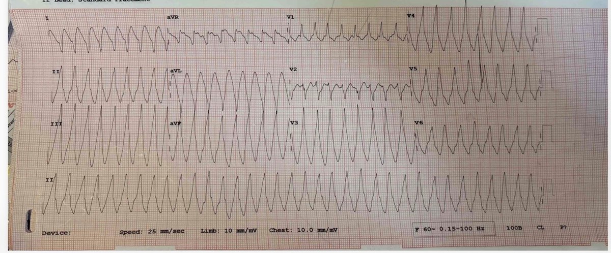 drameya's tweet photo. What is the SOO of this VT? @indian_rhythm @HRSonline #EP #VT https://t.co/oswup3G08Z