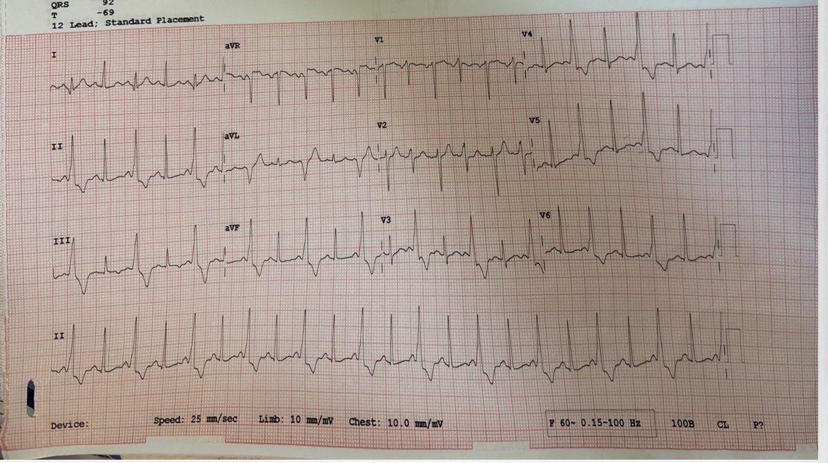 drameya's tweet photo. What is the SOO of this VT? @indian_rhythm @HRSonline #EP #VT https://t.co/oswup3G08Z