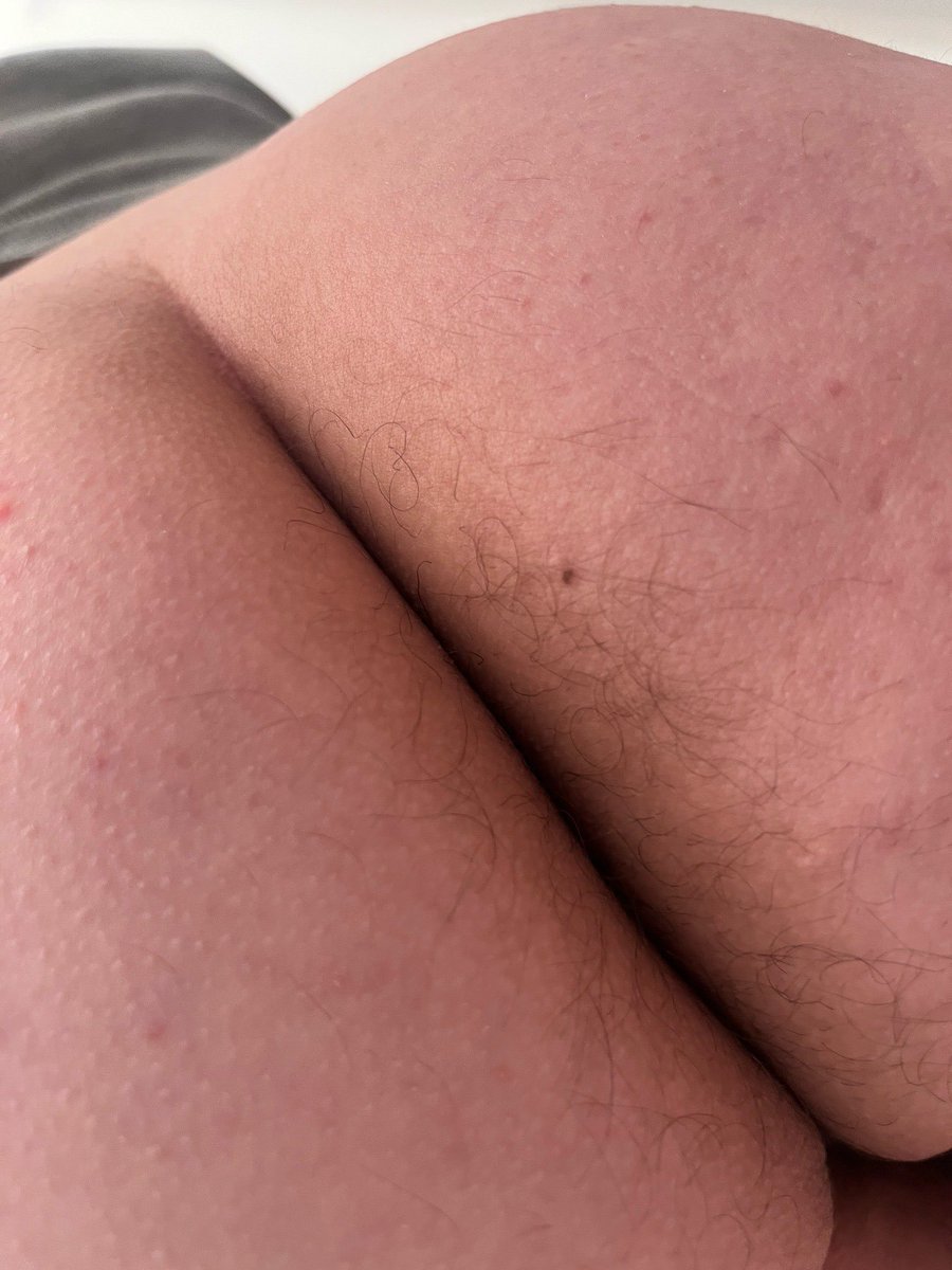FXRTSTEEL's tweet photo. 𝙋𝙃𝙀𝙇 just posted his bubble cheeks to the 𝐇𝐄𝐀𝐑𝐓𝐒𝐓𝐄𝐄𝐋 𝙊𝙁'𝙎 𝙋𝘼𝙂𝙀.

📲: oops, i forgot to wax the hairs, but it still smells good! another question…‼️ do you like..  my shaking moves? <33 -🩵 https://t.co/o1jd6pxy5v