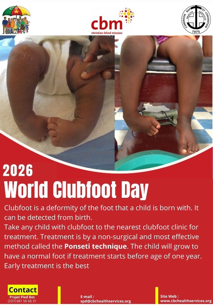 CBCHSORG's tweet photo. 📅 World Clubfoot Day 2026 is at the corner!

It is a treatable birth condition, and early action makes all the difference. With the non-surgical Ponseti technique, children can grow up with fully normal feet. https://t.co/axYdwM0Rz1