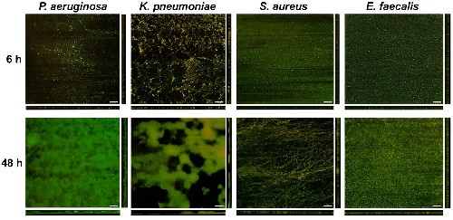 MicrobioSoc's tweet photo. Identifying markers of biofilm formation on medical-grade stainless steel as a representative medical device material. Published Open Access and fee-free in Microbiology using a Publish and Read agreement: https://t.co/VtQ6MyhI4X 

#MicrobioJ #PublishandRead https://t.co/7SabpiSZ54