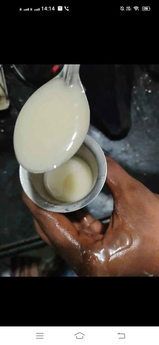 ChatGPTJob's tweet photo. நேற்று இரவு 11 மணிக்கு இரண்டாவது மகனுக்கு கைட்டை விரலில் லேசான தீக்காயம் ஏற்பட்டது. உடனே கொப்பளித்தது, தாங்க முடியாத வலியும் எரிச்சலும் அதிகமானது...

வெற்றிலைக்கு போடும் சுண்ணாம்பு ஒரு ஸ்பூன் தண்ணீரில் ஊற வைத்து இரண்டு நிமிடங்களில் தெளிந்த நீர் கிடைக்கும்.. இந்த சுண்ணாம்பு தெளிந்த நீரில் சம பங்கு நல்லெண்ணெய் கலந்து இடைவிடாமல் கலக்கும்போது வெண்ணெய் போல் களிம்பு(கிரீம்) ஆக மாறிவிடும்..(படத்தில் உள்ளது போல்)

மகனுக்கு தீக்காயம் ஏற்பட்டவுடன் இதை உடனடியாக தயார் செய்து தீப்புண்ணில் வைத்தவுடன் உடனடியாக குளிர்ச்சியாக உணர்ந்து வலியும் எரிச்சலும் உடனே மறைந்தது...

சுண்ணாம்பு நீரையும் நல்லெண்ணெயையும் கலந்து தீப்புண்களுக்குப் பயன்படுத்தும் முறை நமது பாரம்பரியத்தில் "சுண்ணாம்புத் தைலம்" அல்லது "வஜ்ர களிம்பு என்று பெயர்.. தீப்புண் பட்ட இடத்தில் இதை தடவினால் தீப்புண் ஆறுவது மட்டுமல்லாமல் ஆரிய பின்பு தளும்பு இல்லாமல் மறையும்..இந்த பதிவை save செய்து வைத்துக் கொள்ளுங்கள் ஏதோ ஒரு நேரத்தில் உங்களுக்கு உதவும்.. நல்லெண்ணைக்கு பதில் தேங்காய் எண்ணெயும் பயன்படுத்தலாம்...

#homeremedies 
Riyaz