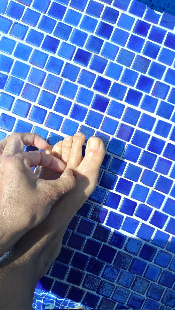 charrisca's tweet photo. Pero el signo de Stemmer sigue siendo positivo porque hay tejido fibrotico ya.
Muchas personas con linfedema y lipedema no van a la piscina porque les acompleja su cuerpo. La presión del agua y el frío nos benefician mucho.Disfrutemos de nuestra terapia! #linfedema #lymphedema https://t.co/0a7xSDa8NO